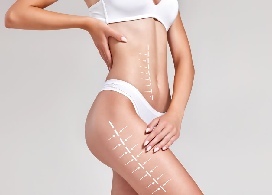 Body Contouring & Sculpting